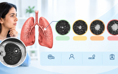 What Size Lung Nodule Is Concerning, and When Does It Need a Biopsy?