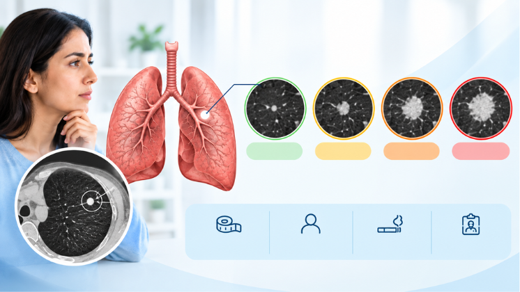 What Size Lung Nodule Is Concerning, and When Does It Need a Biopsy?
